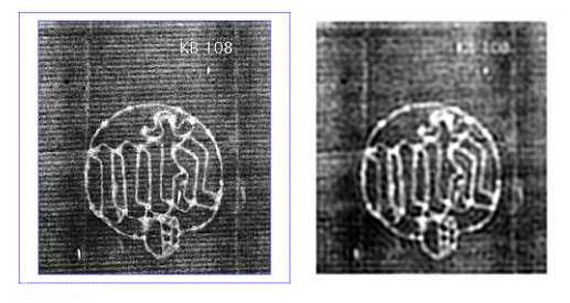 {Filtering of radiograph image}