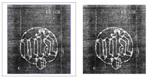 {Filtering of radiograph image}