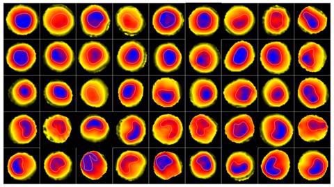 Common carotid artery velocity profiles, imaged by MRI © David Steinman