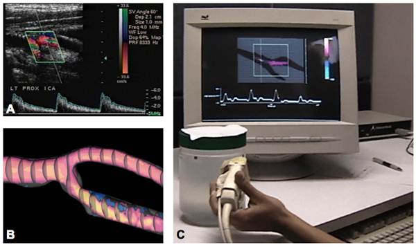 Evolution of virtual Doppler ultrasound © David Steinman